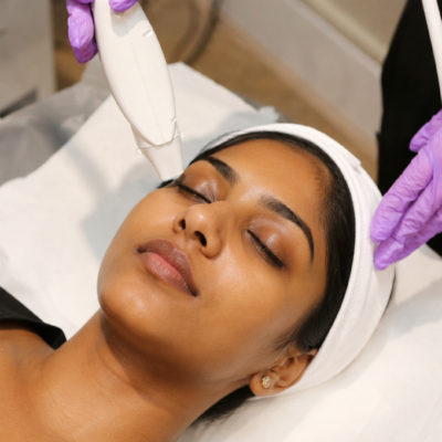 Microneedling