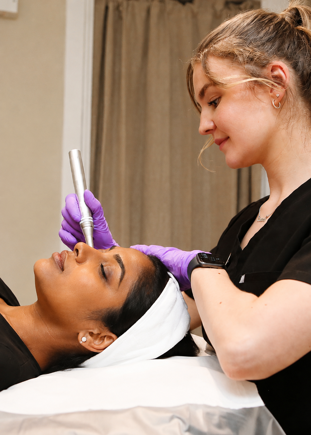Microneedling birmingham treatment for acne scars and skin texture