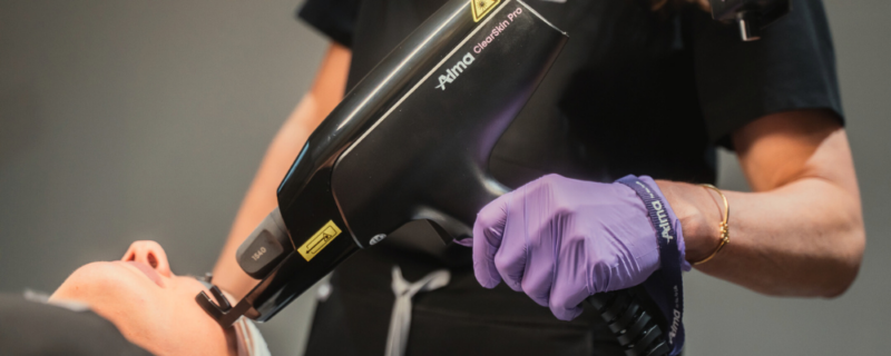 ClearSkin Pro acne laser treatment in Birmingham