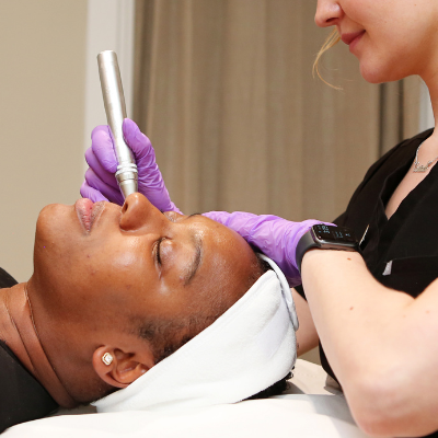 Microneedling