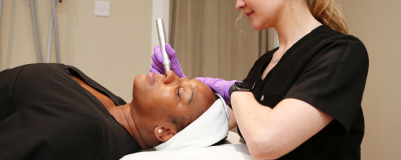 Microneedling birmingham