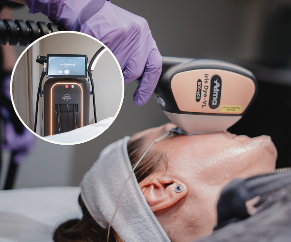alma harmony laser offer