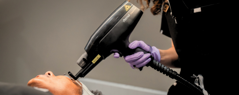 laser rejuvenation treatment birmingham
